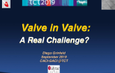 TAVI Valve-in-Valve: A Real Challenge?
