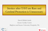 Point/Counterpoint: Provocative Views #2 - Strokes After TAVR Are Rare and Cerebral Protection Is Unnecessary