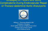 Strategies to Solve Unexpected Major Complications During Endo Repair of Thoracoabdominal Aneurysms