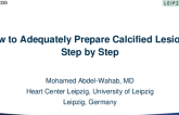 How to Adequately Prepare Calcified Lesions, Step by Step