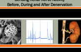 Sensing Renal Nerve Activity Before, During, and After Denervation I: Autonomix