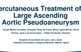 Spain Presents: Percutaneous Treatment of a Large Ascending Aortic Pseudoaneurysm