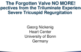 The Forgotten Valve NO MORE! Perspectives from the Triluminate Experience in Severe Tricuspid Regurgitation
