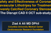 TCT 27: Safety and Effectiveness of Coronary Intravascular Lithotripsy for Treatment of Severely Calcified Coronary Stenoses: The Disrupt CAD II study