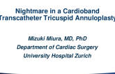 Second Place Winner Case:Nightmare in a Cardioband Transcatheter Tricuspid Annuloplasty