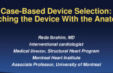 Case-Based Device Selection: Matching the Device With the Anatomy