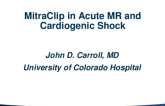 MitraClip in Acute MR and Cardiogenic Shock