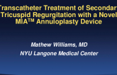 Featured Technological Trends: Mitral, Tricuspid, and Other SHD Technologies - Transcatheter Treatment of Secondary Tricuspid Regurgitation With the Novel MIATM Percutaneous Annuloplasty System