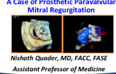 Case-Based Learning: Paravalvular Mitral Prosthetic Regurgitation
