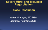 Case Resolution:How We Treated Severe DMR and Severe TR