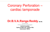 Session I: Coronary Complications - Coronary Perforation/Tamponade