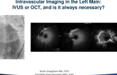 Intravascular Imaging in the Left Main: IVUS or OCT, and Is It Always Necessary?