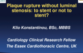Plaque Rupture Without Luminal Stenosis: To Stent or Not to Stent?