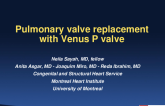 Case 4 (D): Pulmonary Valve Replacement With Venus P Valve