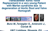 Slovenia Presents: VIV Treatment of Degenerated Bio-Bentall With TAVI