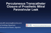 Argentina Presents: Percutaneous Transcatheter Closure of Prosthetic Mitral Paravalvular Leak