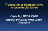 Case 6 (From Singapore): Transcatheter Tricuspid Valve-in-Valve Treatment