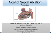 The Alcohol Septal Ablation Procedure