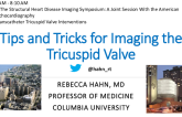 Echocardiographic Imaging of the Tricuspid Valve:Tips and Tricks