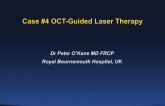 Case #4: OCT-Guided Laser Therapy in ISR
