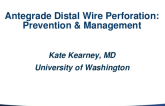 Antegrade Distal Wire Perforations: Prevention and Management