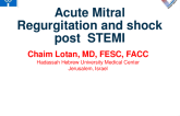 A Patient With STEMI, MVD, and Cardiogenic Shock - Case Introduction