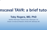 When Transfemoral Is NOT an Option for TAVR, I Prefer... - Transcaval TAVR: A Brief Tutorial