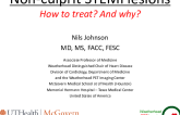Non-Culprit Lesions in STEMI: Update on FULL REVASC
