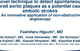Featured Technological Trends - A Novel Technique to Detect Spontaneously Ruptured Aortic Plaques as a Potential Cause of Embolic Strokes: An Innovative Application of Non-Obstructive Angioscopy(Nuvera)