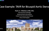 Case Example: TAVR for Bicuspid Aortic Stenosis