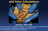Session II: RCIS Advanced Session — Interventional Hemodynamics of the Aortic Valve - Hemodynamics of Aortic Stenosis and Valve Calculations