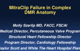 Case of MitraClip Failure in Complex DMR Anatomy