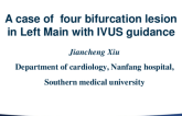 Stent Implantation in a LMCA Lesion With Quadrification (Four Daughter Vessels)