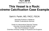 This Vessel Is a Rock: Extreme Calcification Case Examples