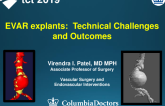EVAR Explants: Technical Challenges and Outcomes