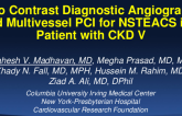 Best Coronary Case of TCT 2019