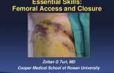 Essential Skills: Femoral Access and Closure