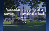 Case 7 (From Taiwan): Vascular Plugging of a Severe Paravalvular Leak