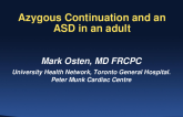 An Adult With Azygous Continuation and an ASD