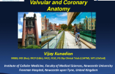 Overview of Cardiac, Valvular, and Coronary Anatomy