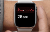 Apple Watch as an ECG? Feasible, May Prove Useful in Emergencies