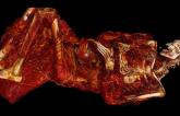 Atherosclerosis Seen in 500-Year-Old Inuit Mummies
