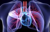 Pulmonary Hypertension During Exercise Foretells Later Risk of Adverse CV Outcomes