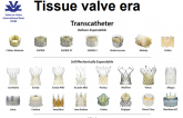 Failed Aortic Valve Bioprostheses: Valve-in-Valve or Redo-SAVR?