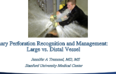 Coronary Perforation Recognition and Management: Large vs. Distal Vessel