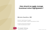 How should we really manage functional mitral regurgitation?