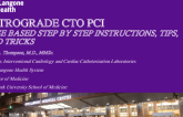 Retrograde CTO PCI: Step-by-Step Instructions, Advanced Tips and Tricks