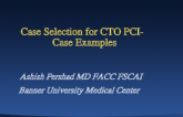 Case Selection for CTO PCI: Case Examples