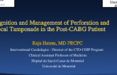 Recognition and Management of Perforation and Focal Tamponade in the Post-CABG Patient