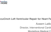 AccuCinch Left Ventricular Repair for Heart Failure